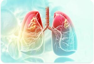 Peripheral lung tumor
