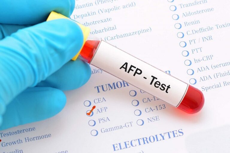 AFP test