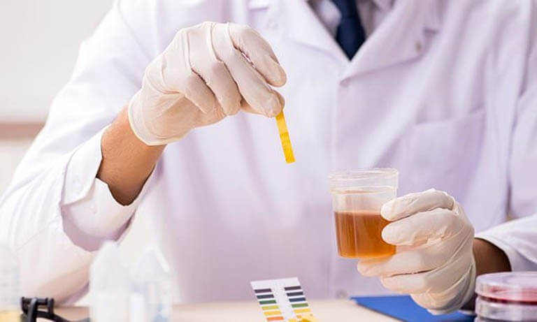 xét nghiệm nước tiểu