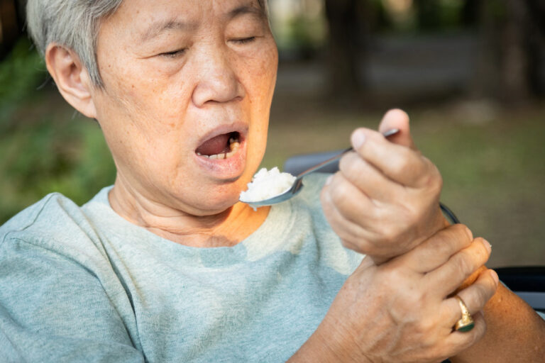 rối loạn nuốt
