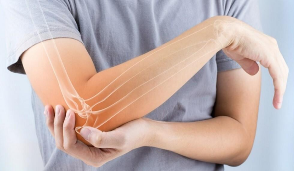 viêm điểm bám lồi