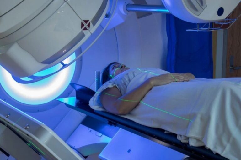 xạ trị ung thư tuyến giáp