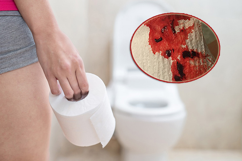 Đái ra máu: Dấu hiệu cảnh báo bệnh tiết niệu không nên chủ quan