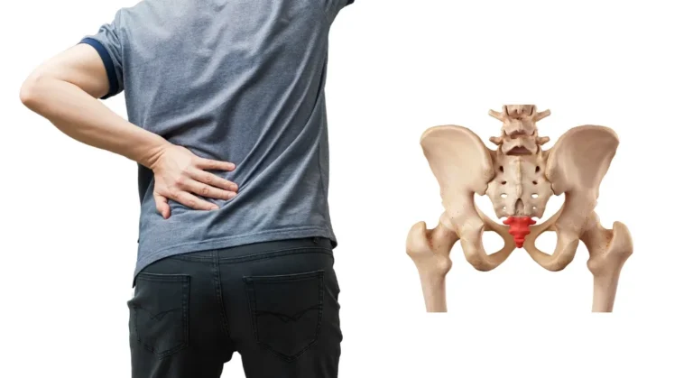 xương cụt bị nhô